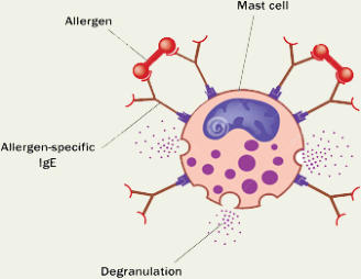 Degranulation einer Mastzelle